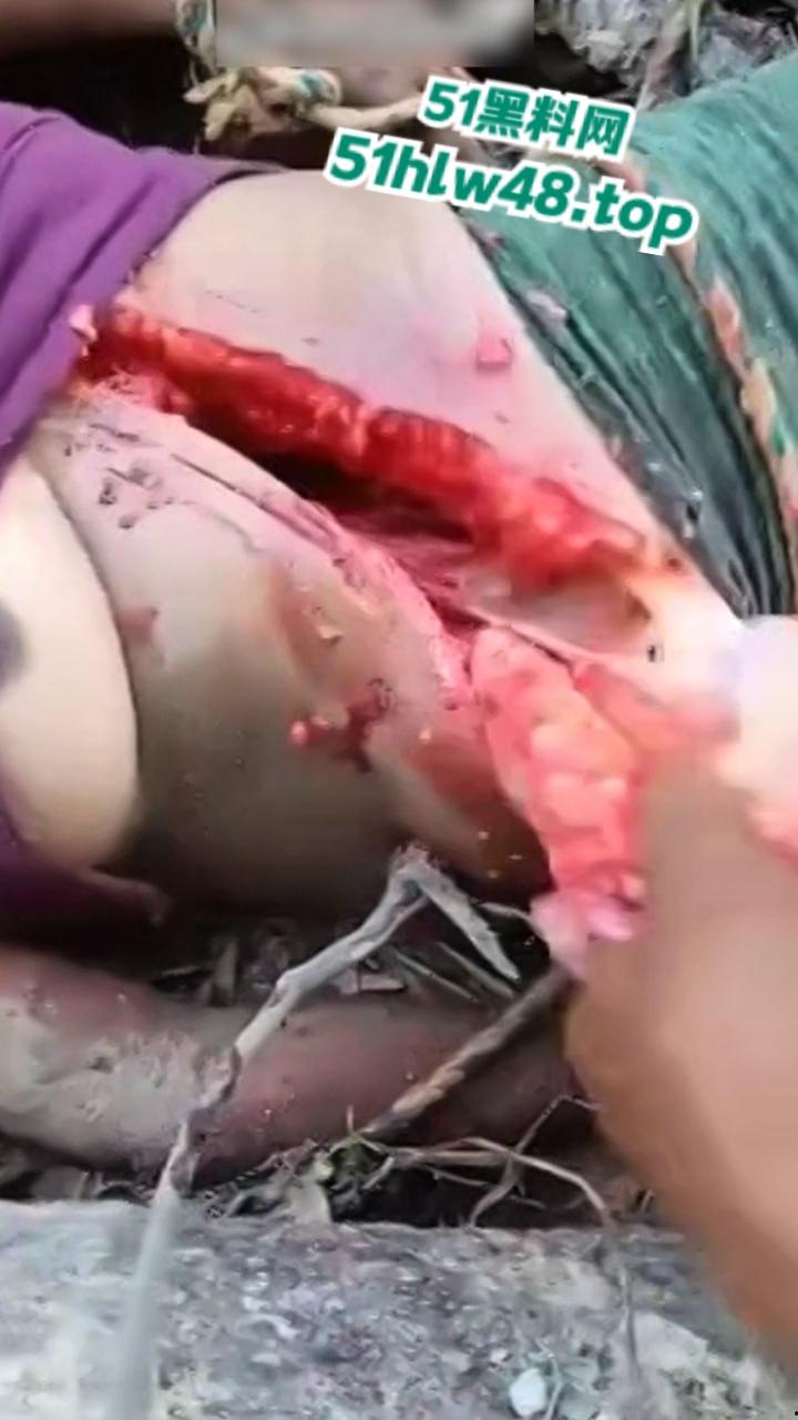 【恐怖血腥】国外大奶美女剖尸现场视频，大坨内脏被扯出，大奶美女和肥猪没啥区别。-4