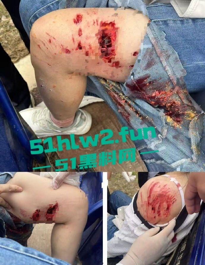 江西赣州四条大型犬公园撕咬母女原视频，狗主人拒绝赔偿系当地小老板，引起了广大网友们热议。-1