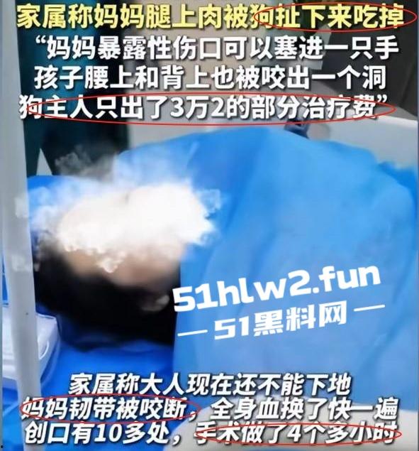 江西赣州四条大型犬公园撕咬母女原视频，狗主人拒绝赔偿系当地小老板，引起了广大网友们热议。-9