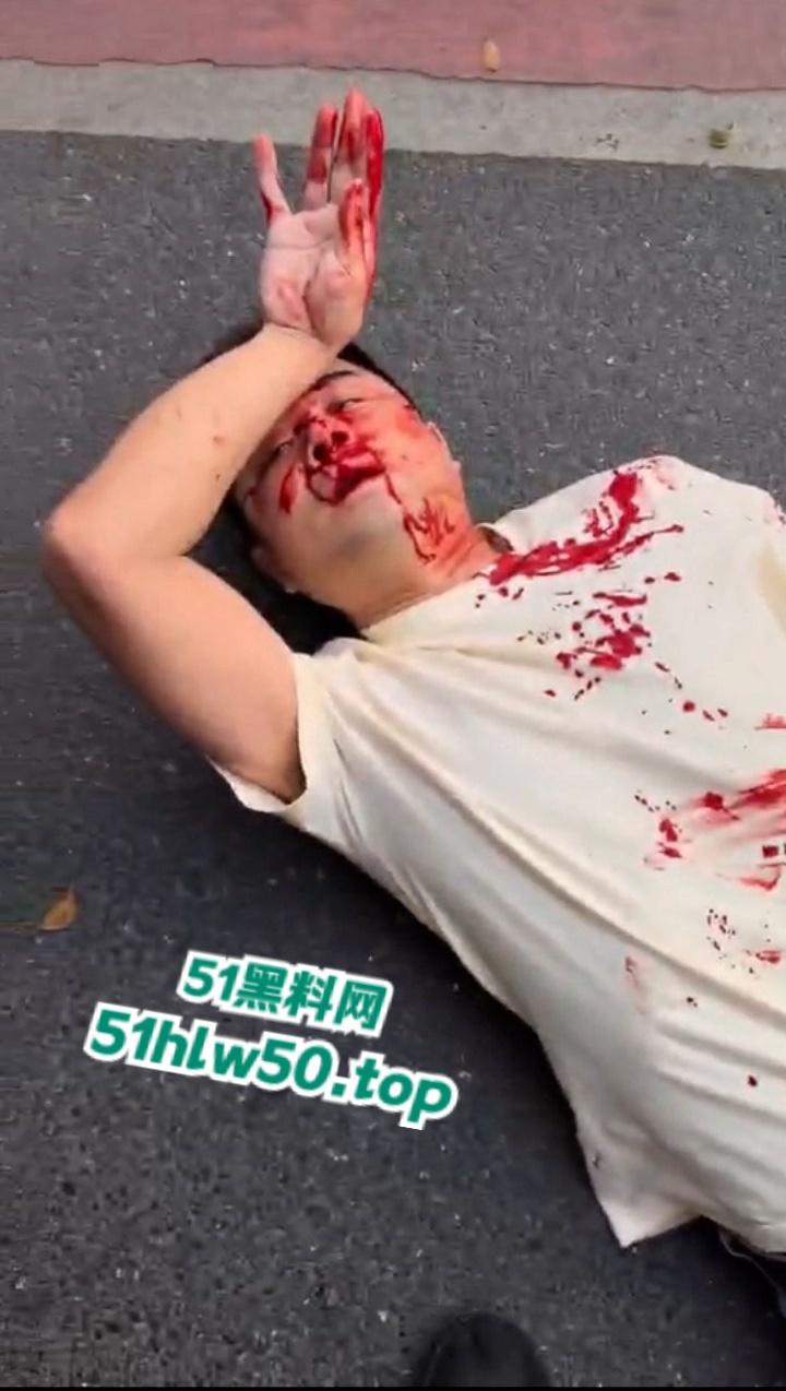 广东潮汕暴躁男在线作死，只因未戴头盔强行躲检撞飞交警双双倒地不起满脸是伤！-3