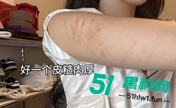 两位抖音百万网红，前CUBA成员【程鑫凯】家暴【鸡腿诺】事件持续发酵，未流出资料曝光完整吃瓜。-23