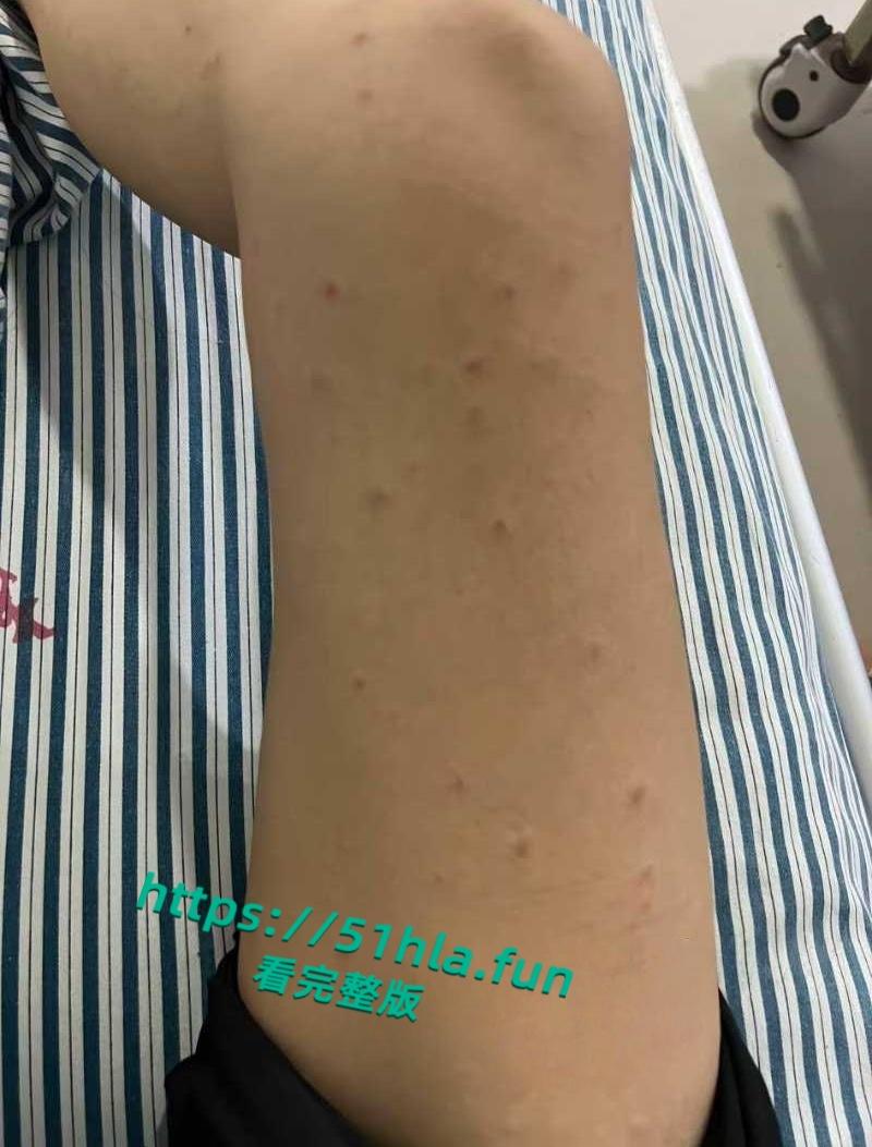 抖音女网红【轮滑冰姑娘】生化母体携带艾滋感染上千人人设翻车，遭网友质疑健康状况引发争议！-16