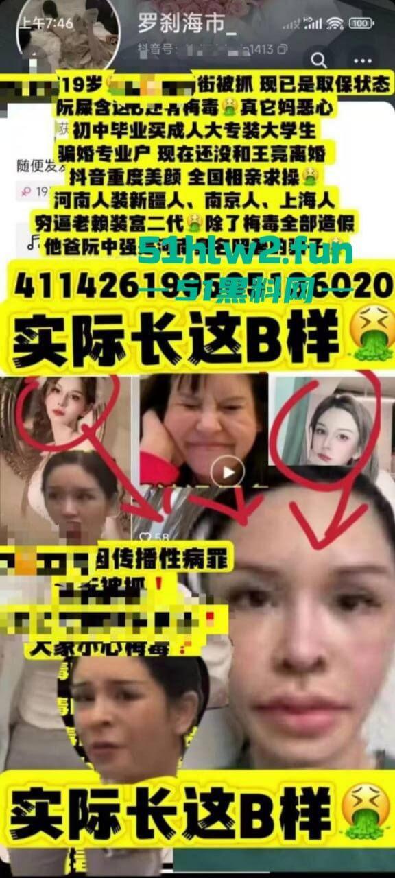 夜场梅毒女【阮诗涵】装嫩卖逼传毒坑害多人，仍在抖音撒网捕鱼专骗老实人全网避雷！-7