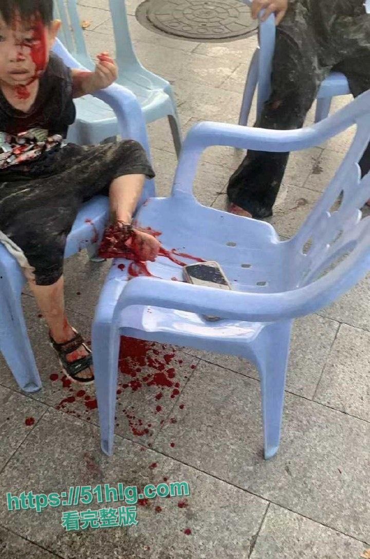 疯狂纵火撞学校！【福建漳州云霄县】司机骇人行径震惊众人，多名学生受伤  现场一片血肉横飞惨象-5