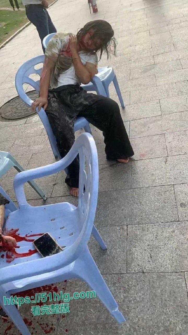 疯狂纵火撞学校！【福建漳州云霄县】司机骇人行径震惊众人，多名学生受伤  现场一片血肉横飞惨象-7