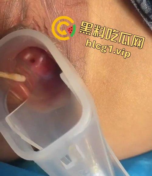 医生偷拍年轻嫩妹王雪检查全程！双腿大开取白带，清纯妹子惨遭曝光！-7