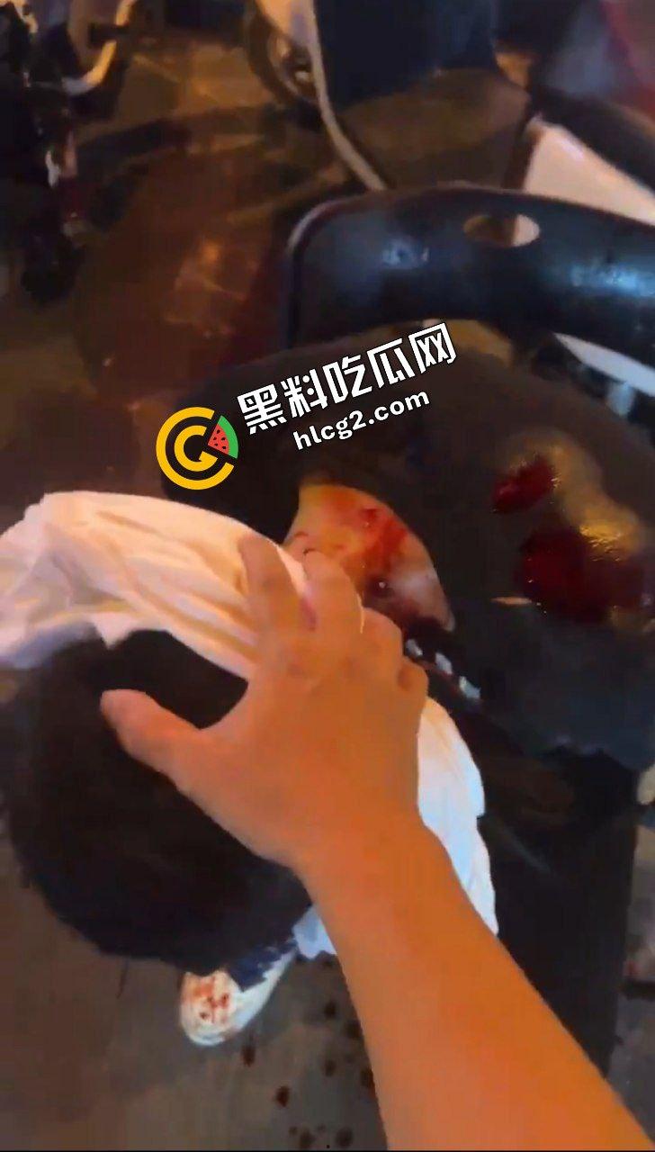 广西玉林南兴广场 精神病男子袭击广场砍人 下死手砍颈动脉 血迹斑斑！致4名小孩受伤！-8