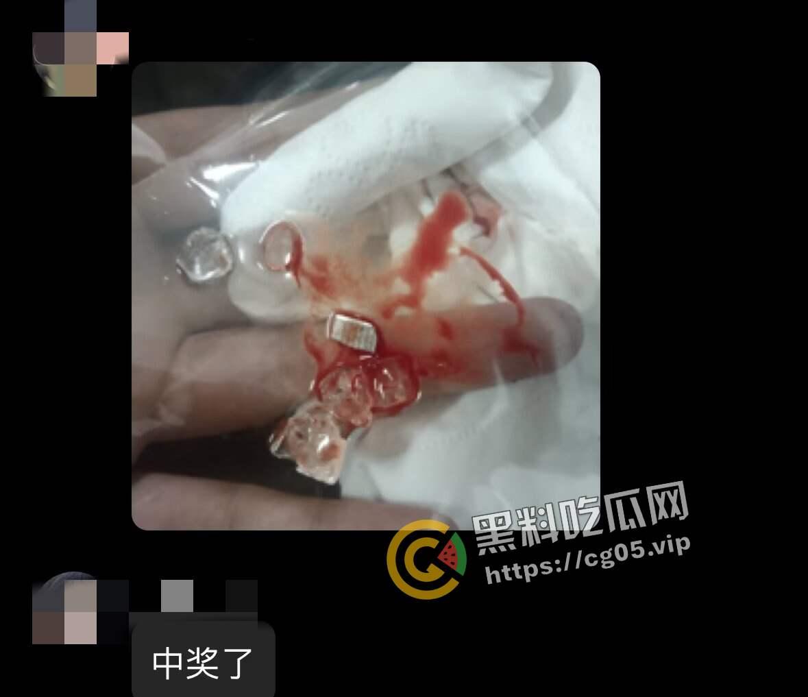 济南幻樱漫展投毒事件!多人在漫展收到免费赠送的零食中发现刀片 药丸等异物 附上相关报道以及漫展骚货视频-2