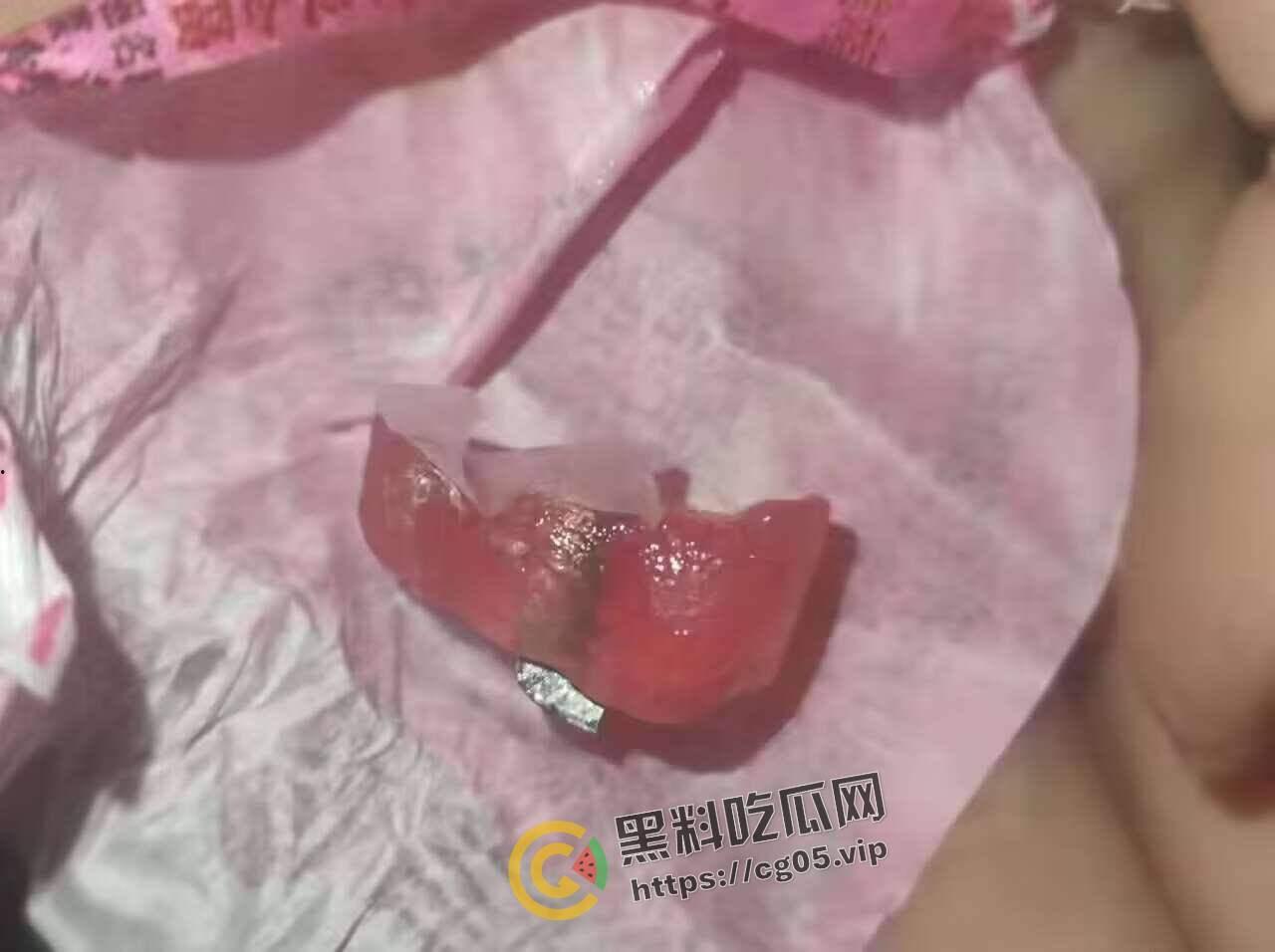 济南幻樱漫展投毒事件!多人在漫展收到免费赠送的零食中发现刀片 药丸等异物 附上相关报道以及漫展骚货视频-7