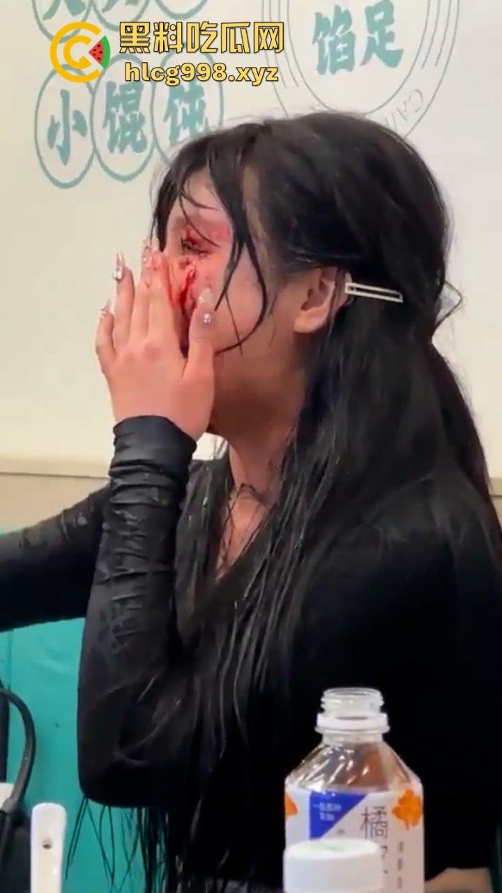 上海俩美女饭店打架下手忒狠 全然不知走光被偷拍 黑衣服这是奶子是真的吗？-9