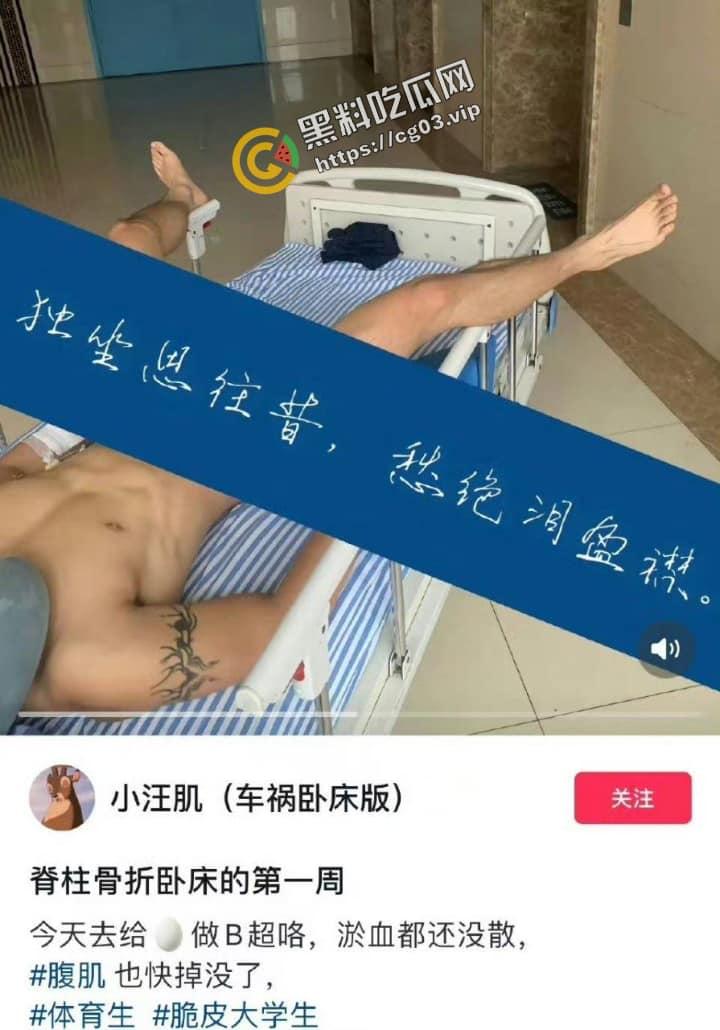抖音【小汪肌】（车祸卧床版）同性恋体育生 真的死了都要作秀-4