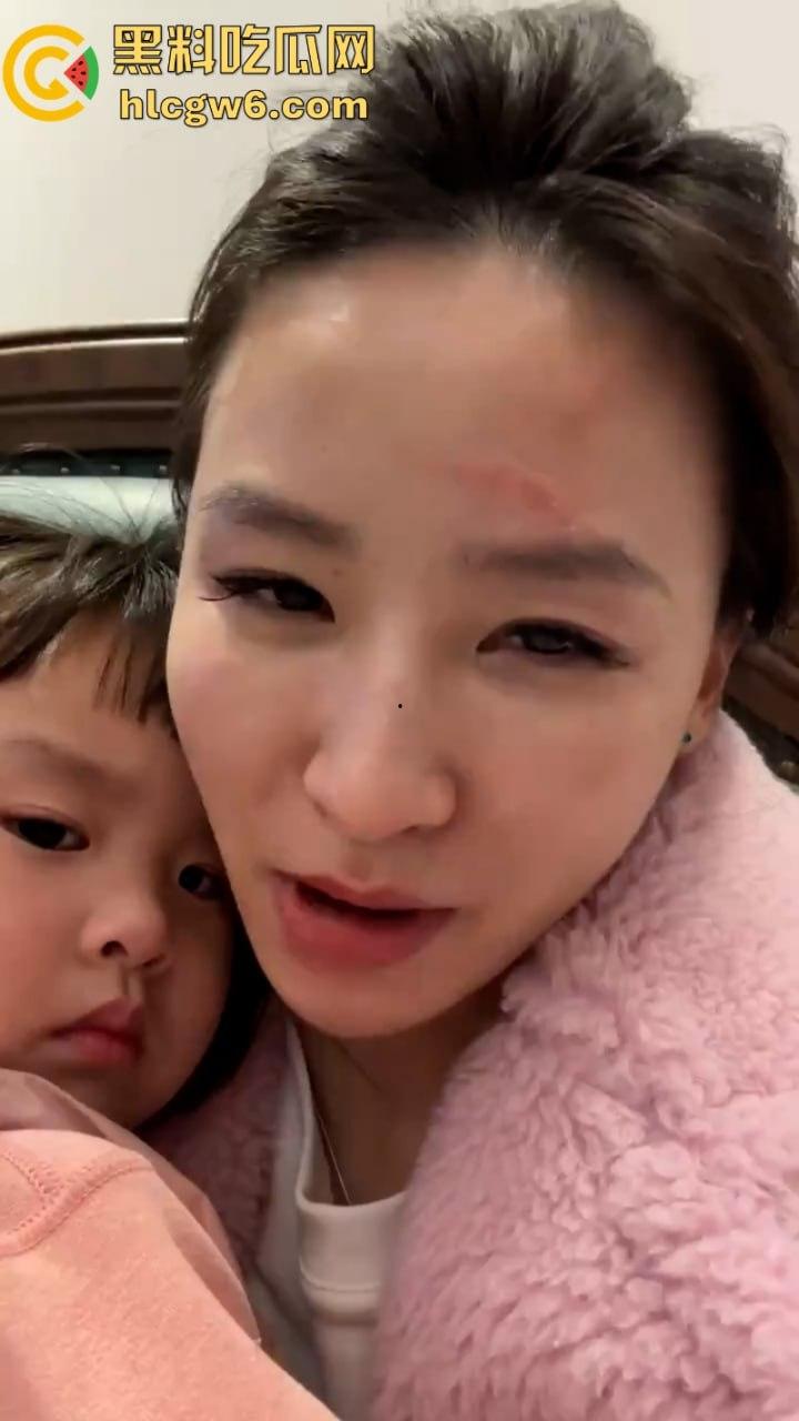 湖北一小学美女老师抖音自曝离婚探女遭前夫爹殴打抓脸全身多处受伤 伤情实拍曝光!都是血口子-4