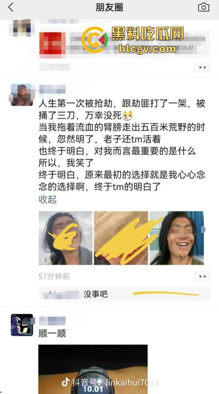 旅游博主在伊朗遭遇持刀抢劫 身中数刀死里逃生 为流量也是不要命了-9