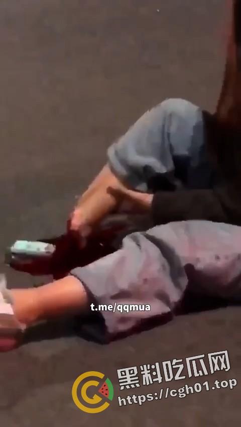 摩托车女骑士装上大货车 小腿直接断掉 现场血腥画面流出-3