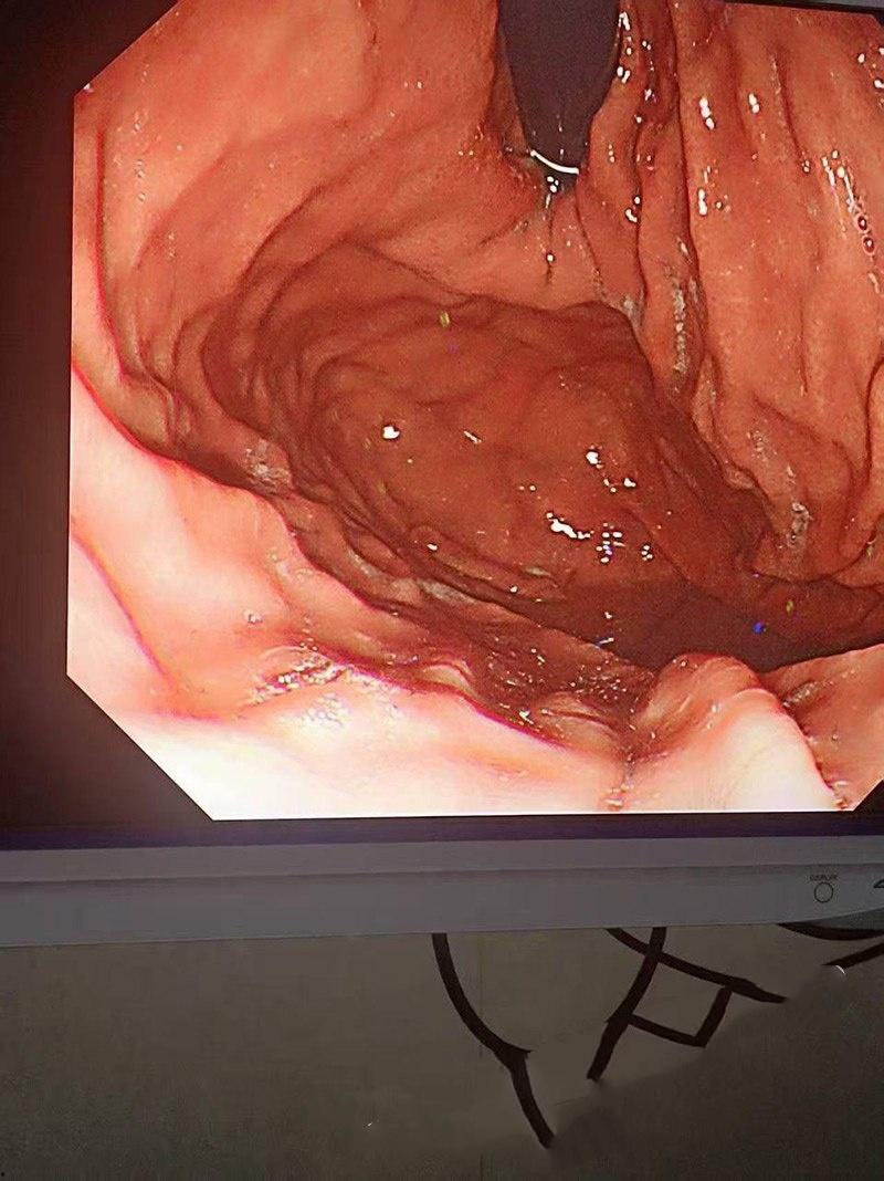 真刺激！男模激情拳交玩过火，结果金戒指卡屁眼里，深夜紧急送医取出，医生直叹牛逼-6