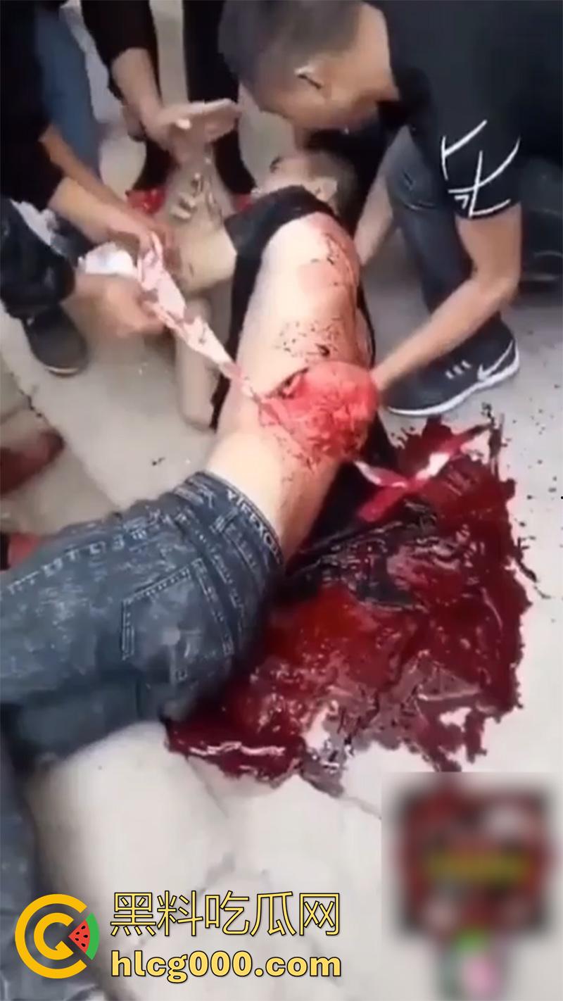 暗网流出恐怖一幕合集，小伙被砍透背部，东南亚混战分尸现场，树林剁头女孩被霸凌跳楼，胆小者勿入啊！-1