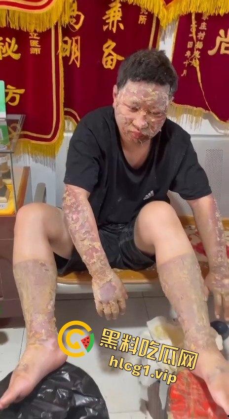 内蒙古呼和浩特惊魂一刻！02年精神小伙偷骑V4机车撞上右转SUV，摩托车当场燃烧！-10