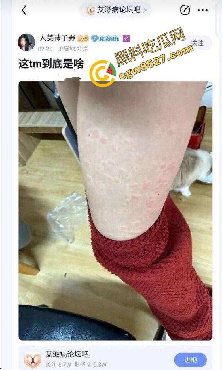 北京清纯美少女沦为拜金婊，荒唐行为后确诊艾滋，她潸然泪下，网友议论纷纷-5