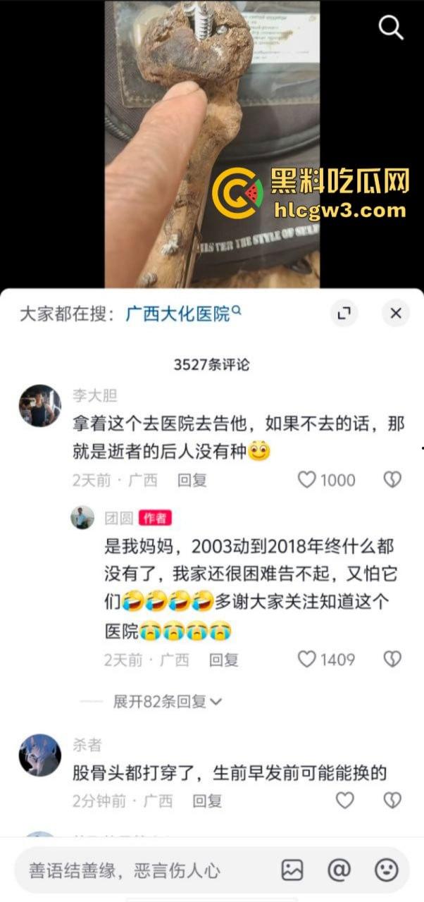 大妈去世后尸骨爆出惊人秘密 广西玉林大化骨科医院恐怖接骨手术让人震惊-2