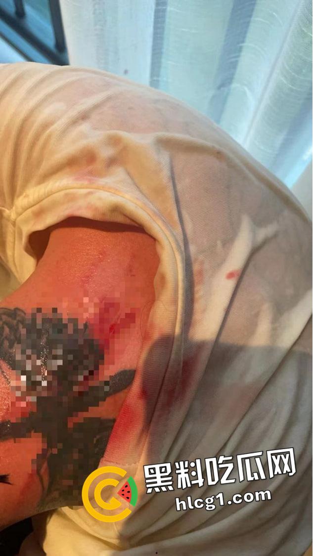 全网丢人的精神小伙【陈浩轩】背着女友偷吃被抓！被女友打的头破血流 现场视频流出-6