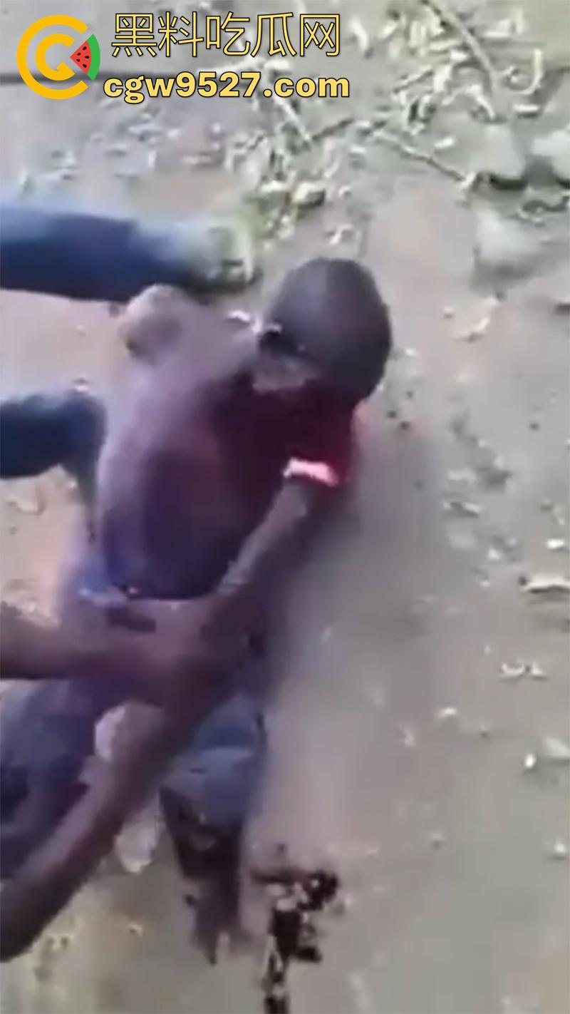 暗网流出血腥合集，吃人腿爆头剥皮车祸，想要的应有尽有，场面血腥过于重口，胆小者谨慎观看！-8