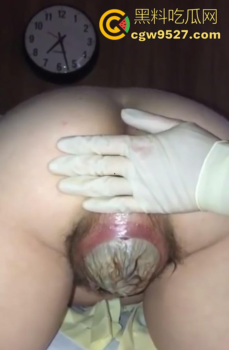 孕妇接生现场画面，体验生孩子的全过程，幸亏是个大肥逼，不然一定痛死了，原来大家都是这么来的啊！-2