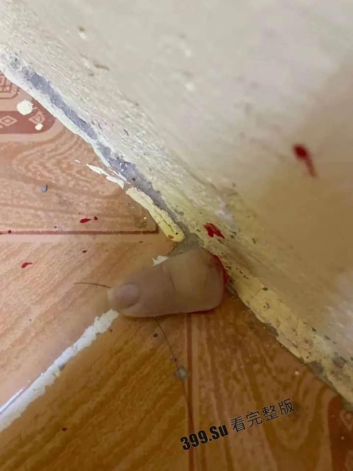 中国女孩王某被人诱骗到柬埔寨 后遭越南人绑架 被切掉一根 手指，并拍摄下视频威胁其国内家人勒索500万-5