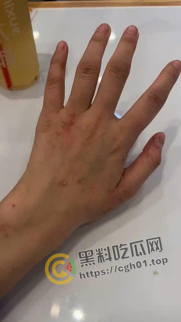 宁波惊现生化母体  圈内全军覆没 医院咨询电话被打爆 夜场公狗母狗的毒圈缩成决赛圈啦-21