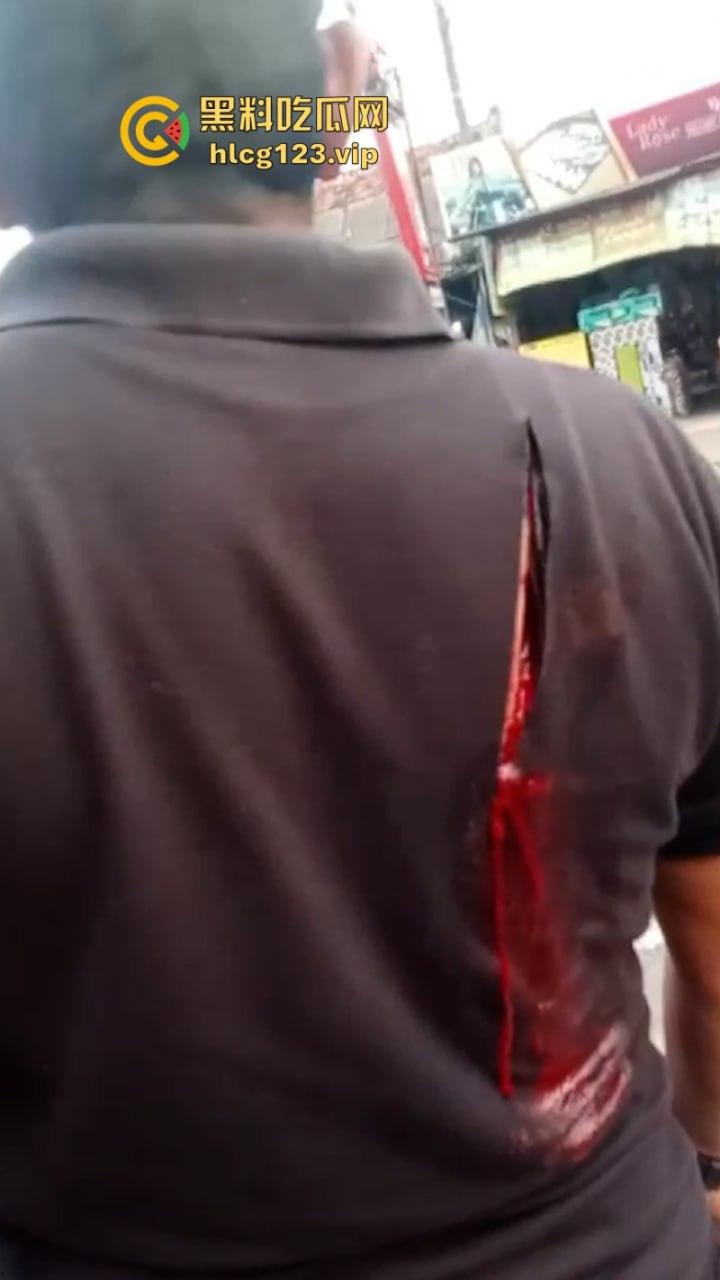 大型皮开肉绽现场！印尼一地发生冲突 有内战的国家真的不要去！-7