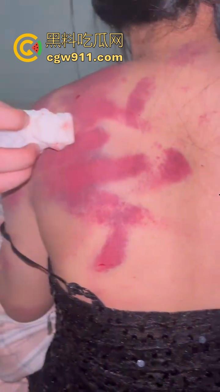 广西精神出租房围殴霸凌敌对小太妹，棍棒齐上，拳打脚踢，脱下衣服伤痕累累，战斗力丝毫不输男的！-8