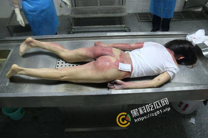 快手网红 史小越 被前男友设局骗至缅北后死亡事件!甜美淑女被冷冻死!尸检照片流出,面带微笑!-10