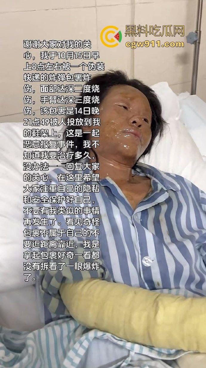 湖南性感擦边主播遭疯狂粉丝寄炸弹包裹炸伤，粉丝疯狂起来真恐怖啊，好端端的性感主播炸成了隔壁大妈！-9