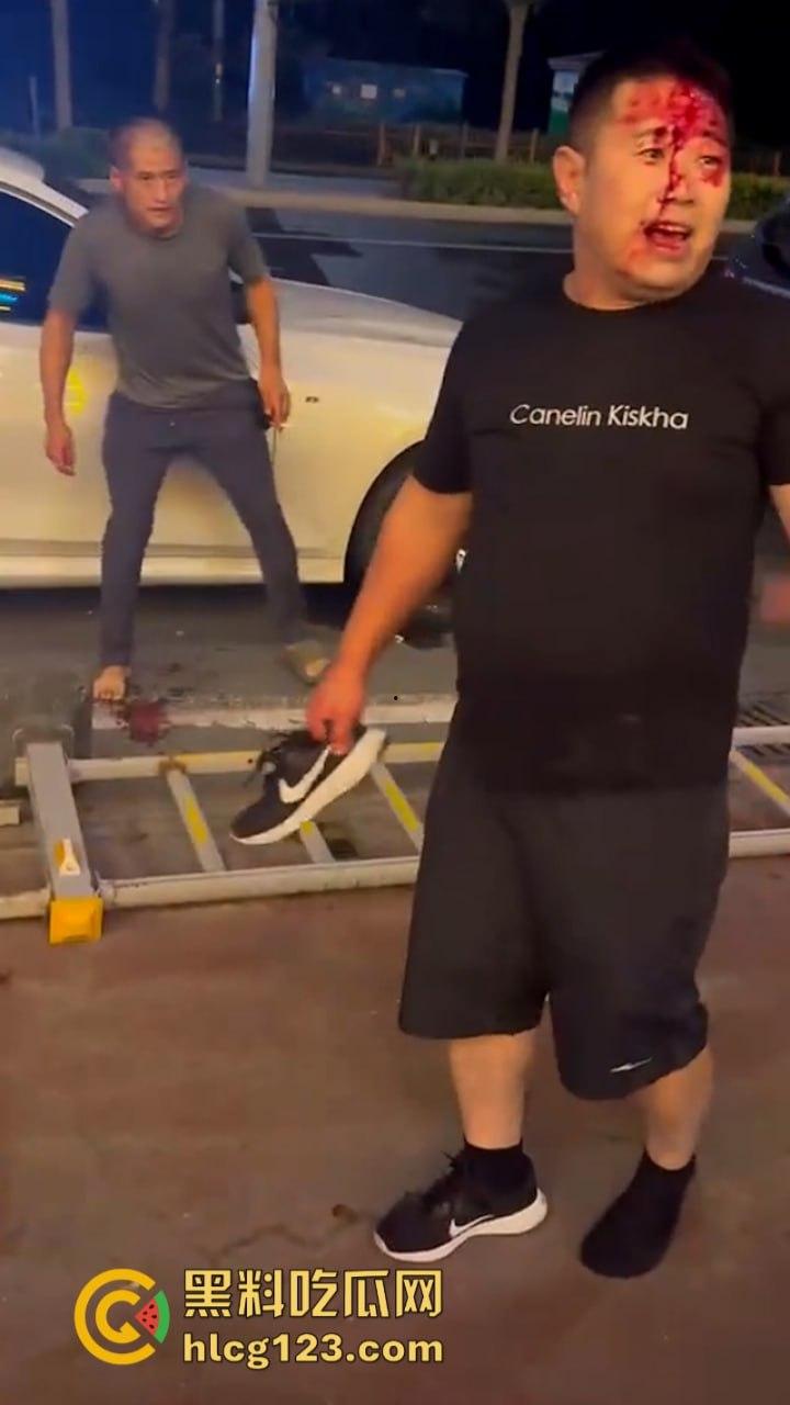 泰州两男子酒后互殴 重拳出击 脑袋都要开花了-4