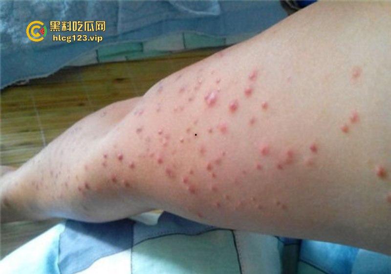 可怕！为了报复社会把带血针头扎进了共享单车的座椅里……山东商业技师学校20个被感染艾滋！！！-7