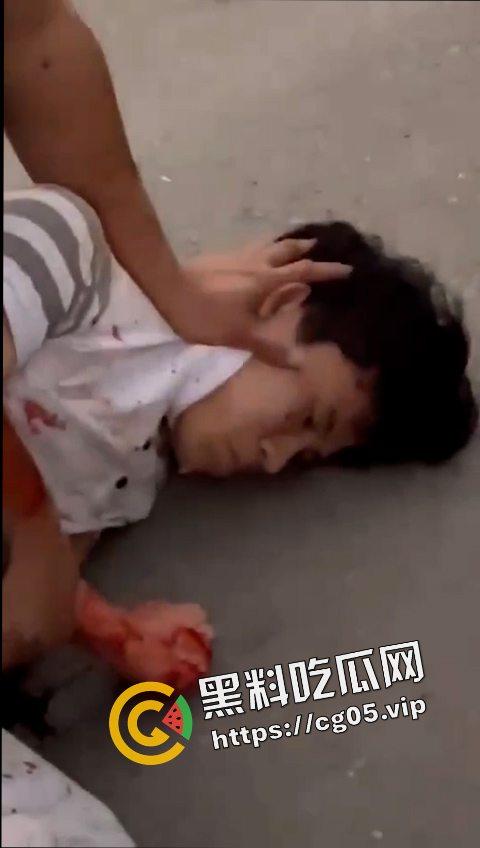 12.19日三亚南滨中学门口精神小伙为爱砍人！现场画面曝光 遍地鲜血 三名女子被砍伤 一人正在抢救中-4