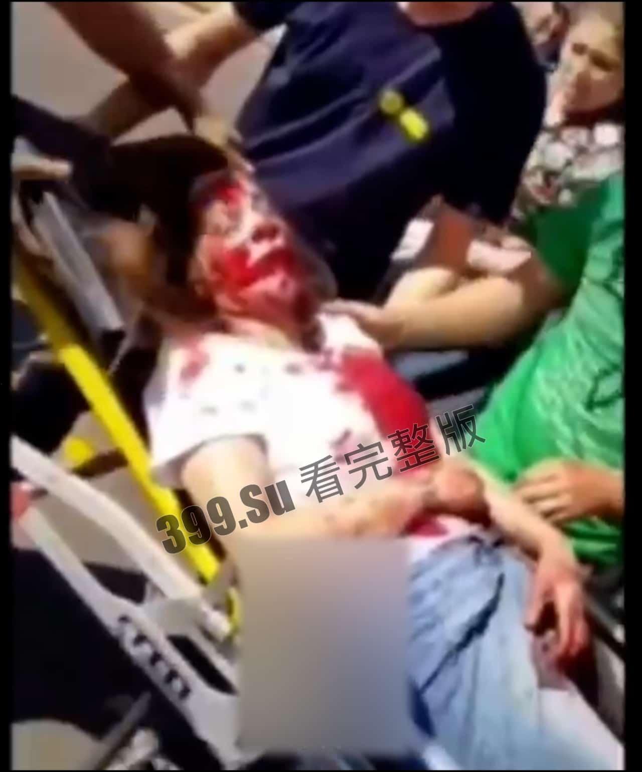 慎点！车祸现场合集，心理承受能力低的瓜友勿点，内有血腥场面-2