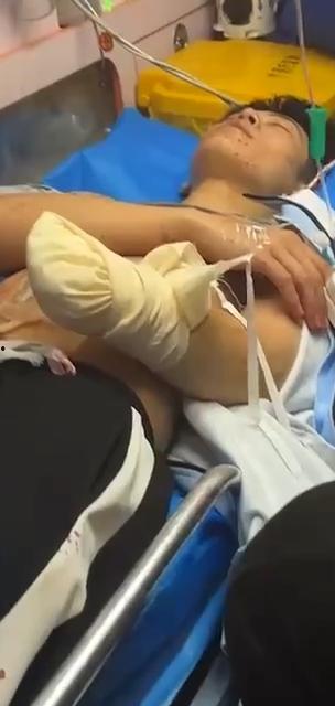 5月23号 厦门华天涉外职业技术学院 直播主 直播中遭刀仔持刀猛砍  左手掌被砍断 现场十分惊悚-6