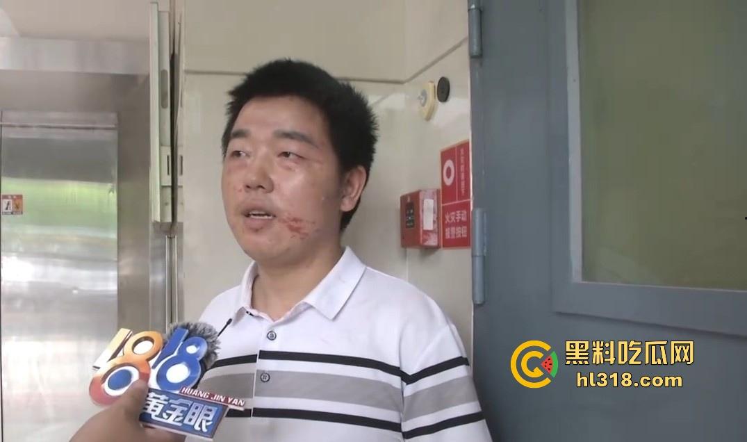 小哥网上想约炮台球助教，想摸人家的丝袜美腿，不料线下被坑5000多，还给打了一顿，真是陪了夫人又折兵！-7