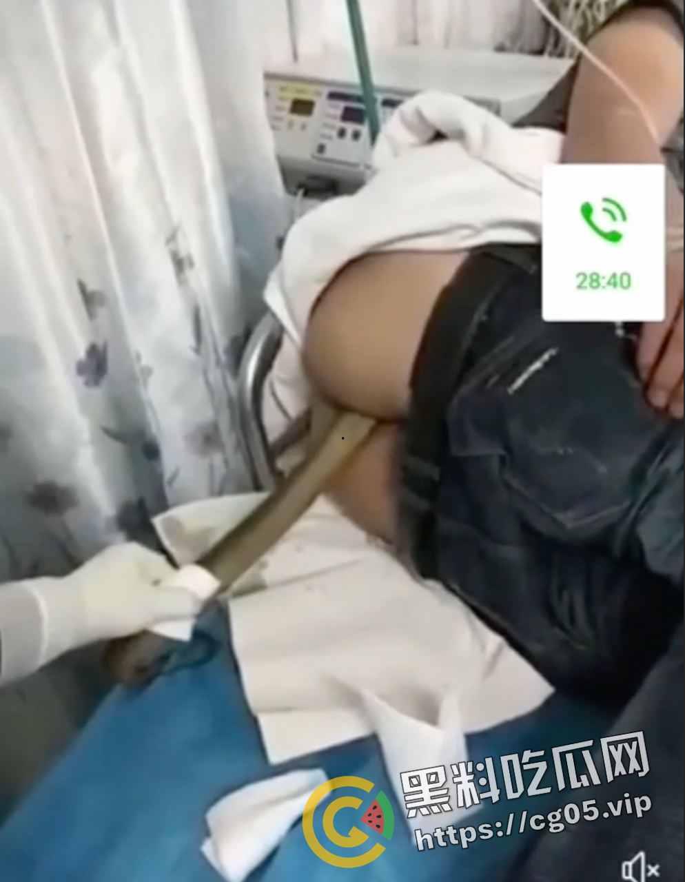 黄鳝入肛 一去不回 整活把自己整进医院了 医生扯出来半米长的黄鳝惊呆了-2