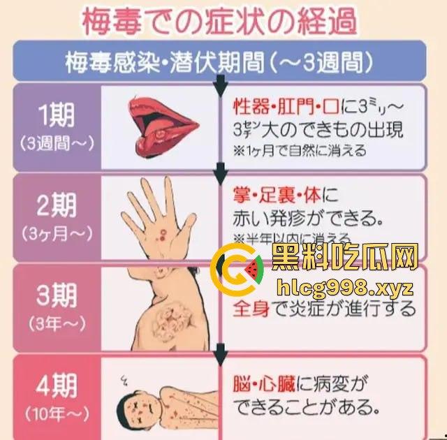 梅毒像疯狗一样乱咬！日本疫情横扫全球，日本卫生部出狠招断根大法安排上，管不住下半身只能禁爱？-10