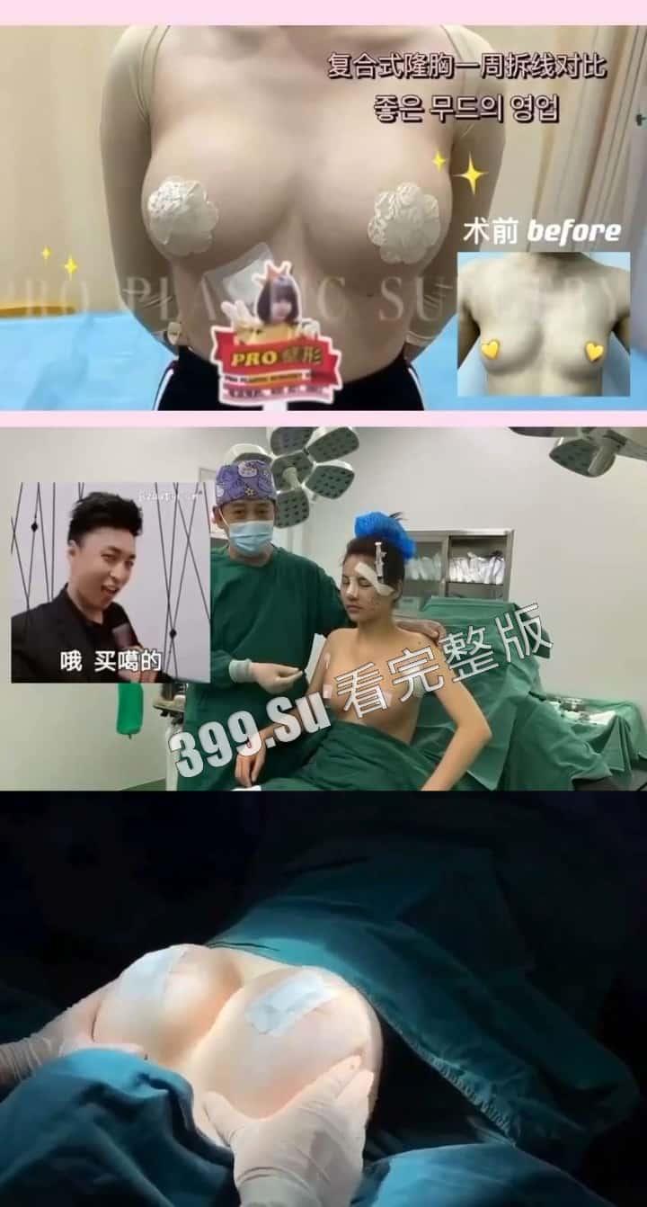 医美整形那些事儿 假的真不了 看的脸皮发麻 (三)-4