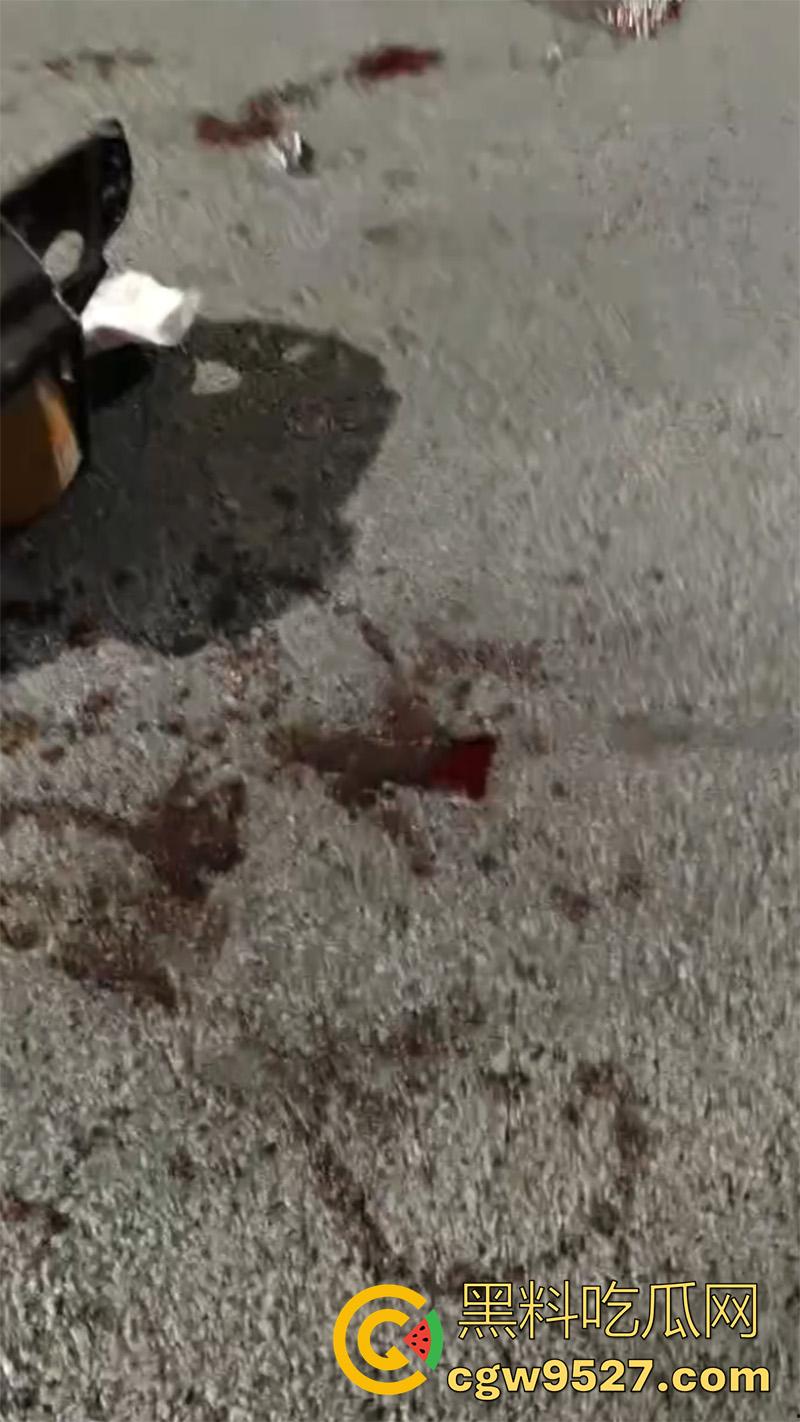 广西柳州鬼火少年，装逼失败翻车现场，自断一臂当场蒙逼，幸亏还留条命，估计再也不敢了吧！-5