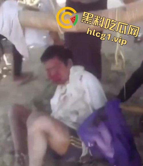 缅甸妙瓦底军阀虐待人质视频曝光，男子被殴打至面目全非，血迹斑斑的恐怖真相！-4