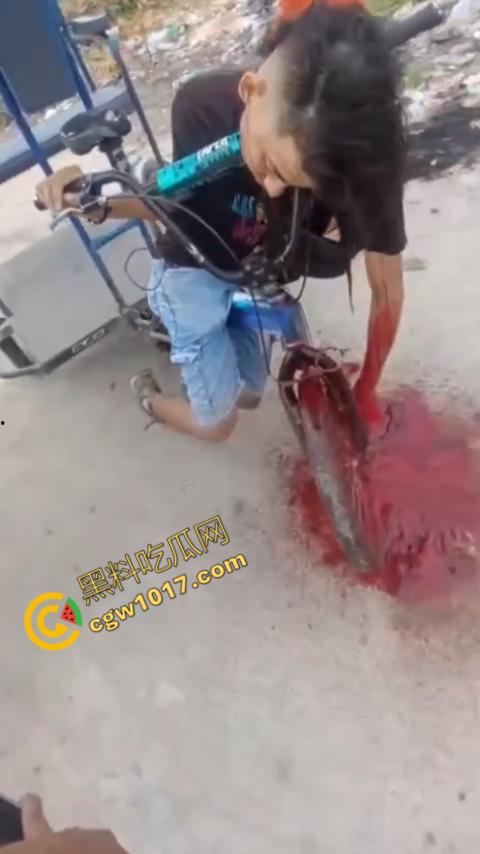 恐怖视频曝光！小伙头颅神秘贯穿，三轮车穿颅血染街头血腥现场骇人惊魂，神秘死亡惊掉下巴！-3