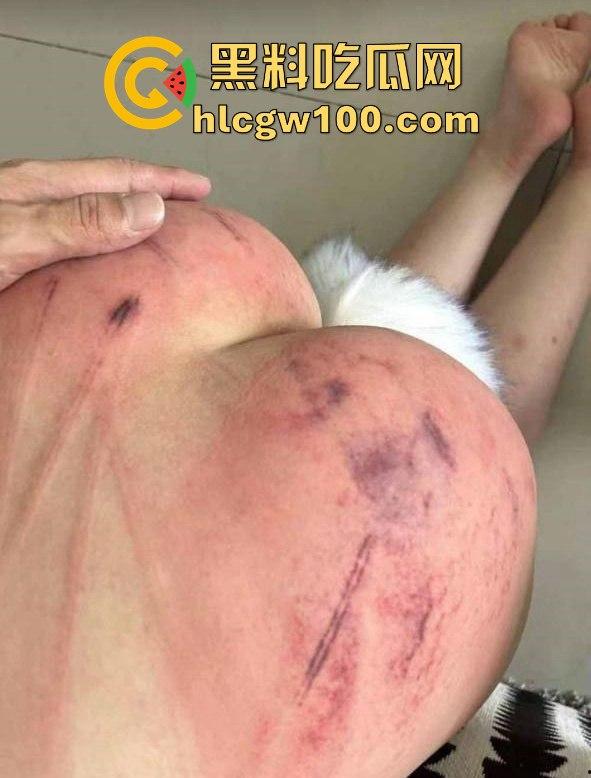 重口味推荐！山东滨州博兴三中学生妹【于翰然】金主SM调教视频流出，追求极致体验屁股都被给打烂流血了。-14