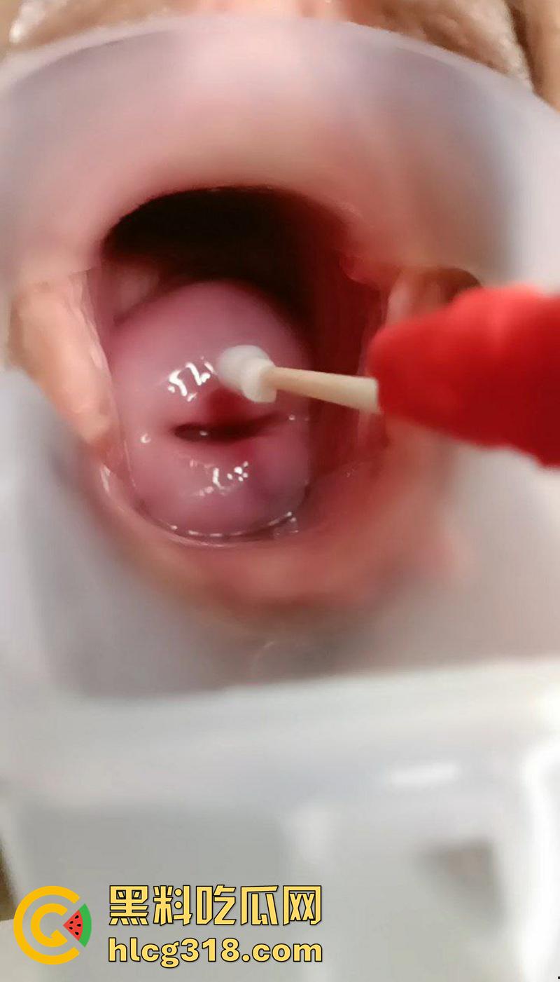 拳头砸逼往死里干，盘点极品大烂逼女孩，极度扩张玩到子宫脱垂，爆插子宫口都给玩脱肛了！-7