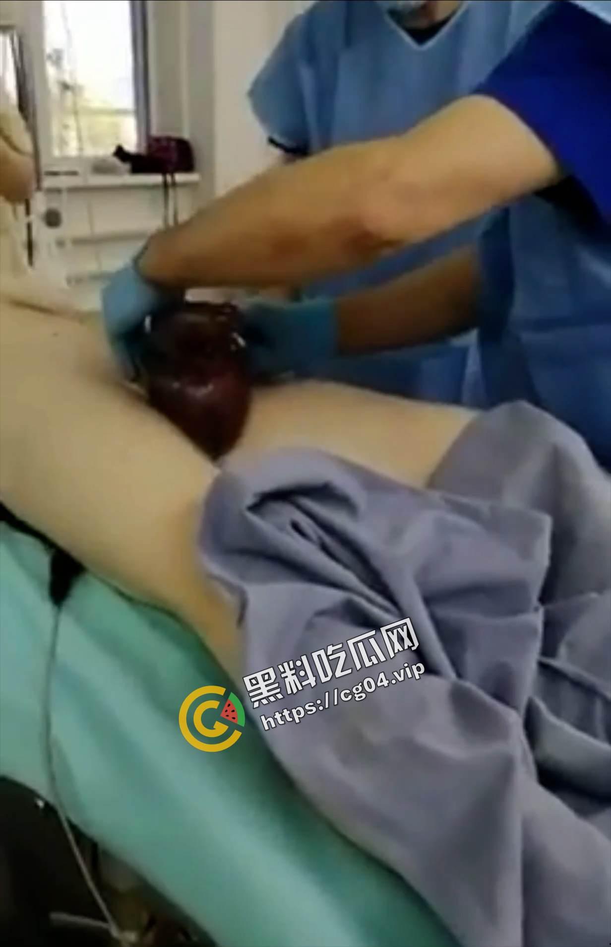 玩的花不是叫你玩命!w外国男子阳具被锁肿成大蒜一样 医生都束手无策-4