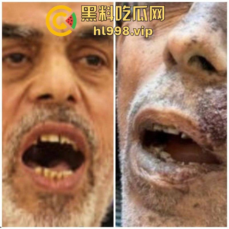 慎入！！！哈马斯领导人辛瓦尔被以方爆头击毙 遗体照片流露不忍直视！-10