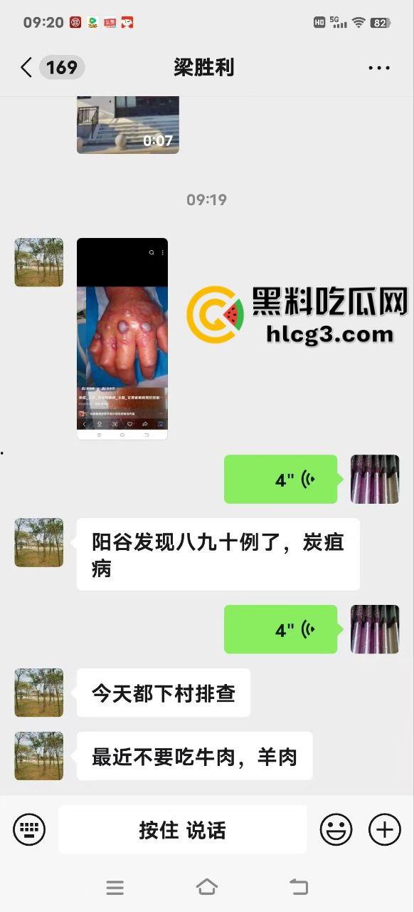 山东聊城阳谷县 一养殖场惊现炭疽病 牛传染人 致当地数十人感染病例-8