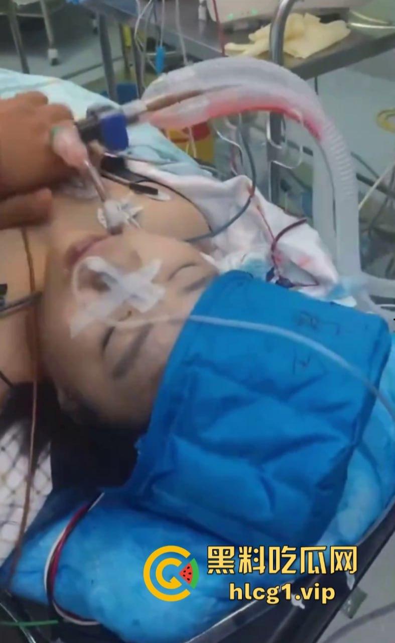 活阎王！哈尔滨市10岁小女孩微创手术身亡 器官被单独摘走！-7